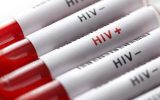 آخرین وضعیت بروز HIV در کشور