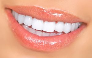 کامپوزیت دندان یا لمینت: راهنمای جامع بهبود زیبایی و سلامت دندان