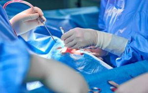 جراحی قطع تشنج کودکان در دانشگاه علوم پزشکی ایران