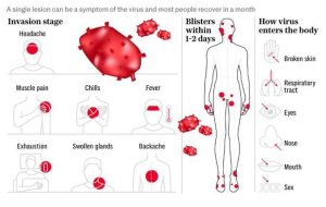 آنچه باید درباره ویروس Mpox یا آبله میمون بدانید